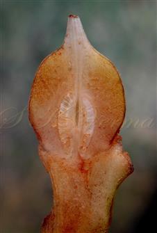  Ovary V.S.